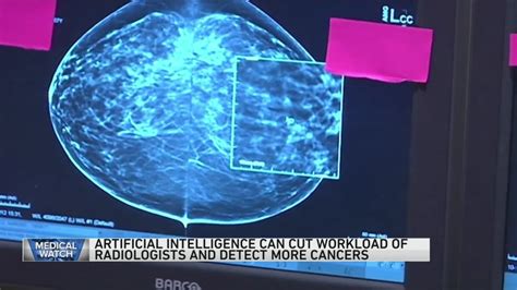 AI and mammograms — plus more stories